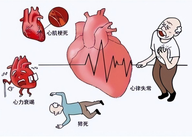 《心肌梗死与心力衰竭基因检测》